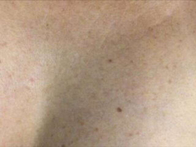 Sändningsbilder Alianakiss